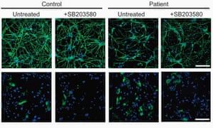 Diferenciación neuronal de neuroesferas tratadas con el inhibidor de p38 SB203580.  Las neuronas se visualizaron mediante tinción inmunocitoquímica de βIII-tubulina (superior) y astrocitos con tinción de proteína ácida fibrilar glial (GFAP, inferior).  Barras de escala, 100 μm