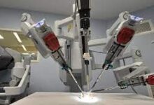 1645727573 Robot realiza la primera cirugia laparoscopica sin asistencia humana y