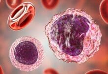 NIMH » El VIH puede persistir durante años en las células de la médula ósea de las personas que reciben terapia antirretroviral